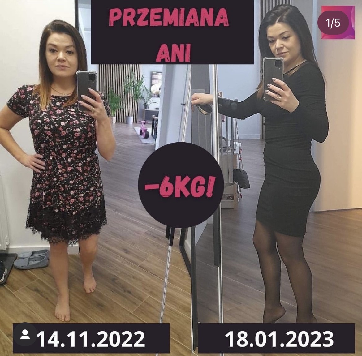 Metamorfoza podopiecznej 2 – zdjęcia przed i po